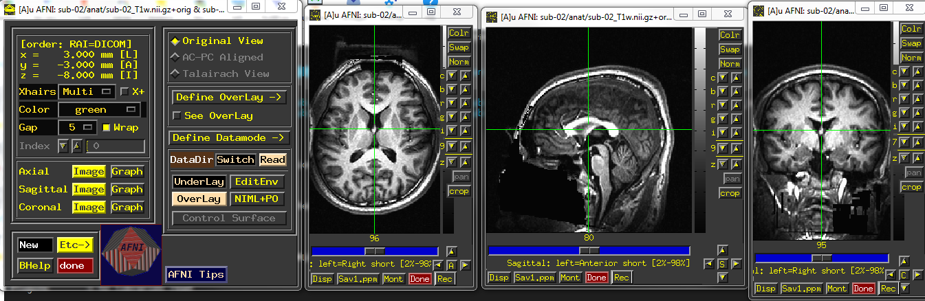../../_images/AFNI_inspect_anat.PNG