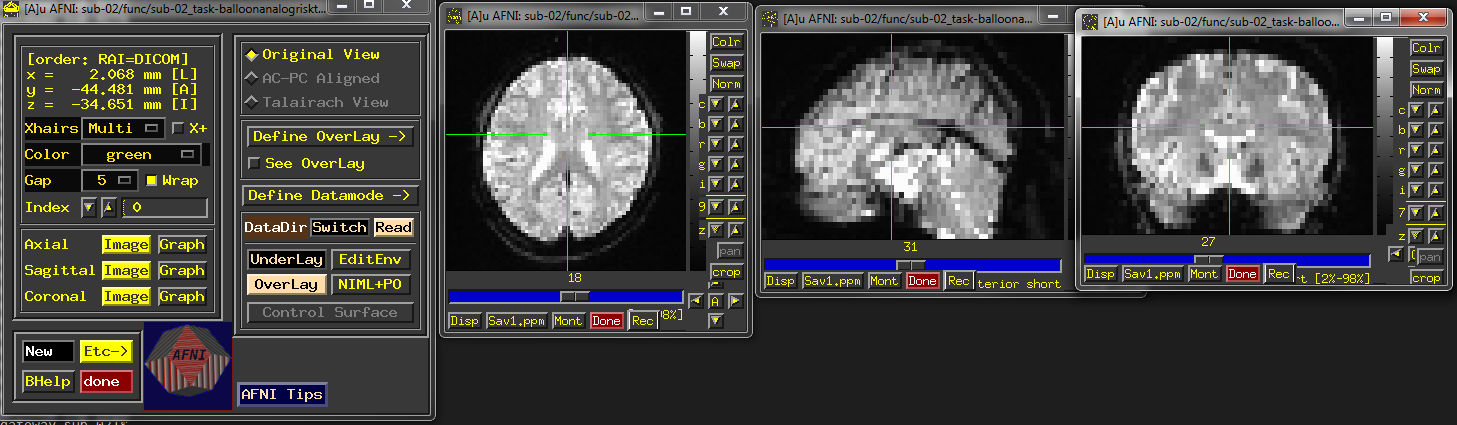 ../../_images/AFNI_inspect_func.PNG