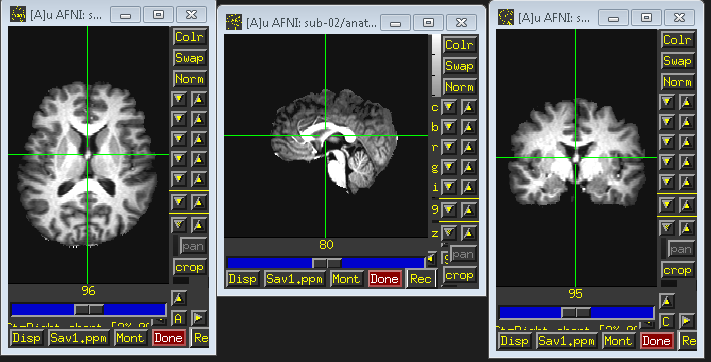 ../../_images/AFNI_skull_option1.PNG