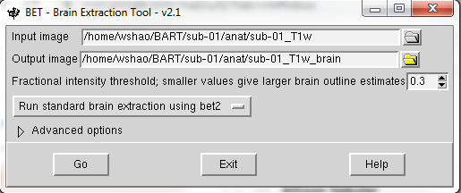 ../../_images/FSL_skull_output.png