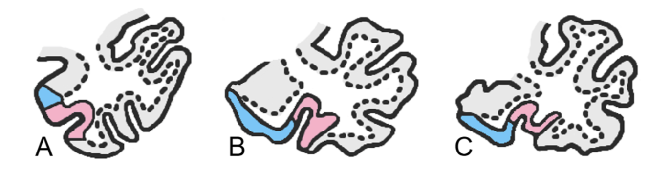 ../../_images/MTL5.png