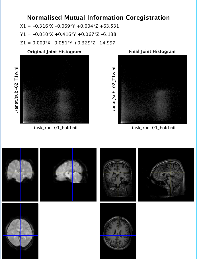 ../../_images/SPM_Coregistration.PNG