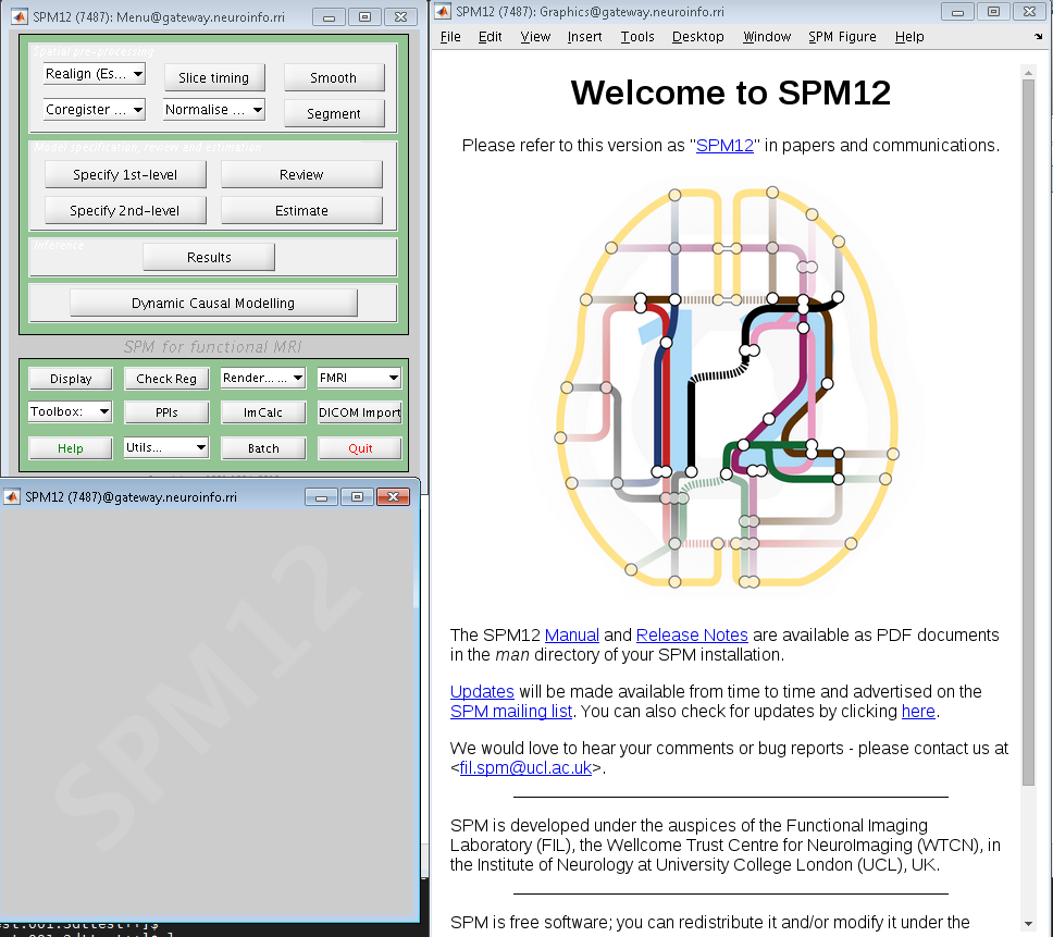 ../_images/SPM_fMRI_GUI.PNG