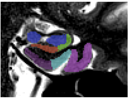 ../../_images/subfield10.png