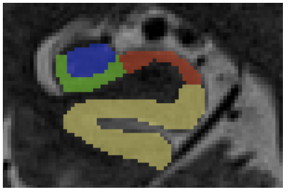 ../../_images/subfield7.png